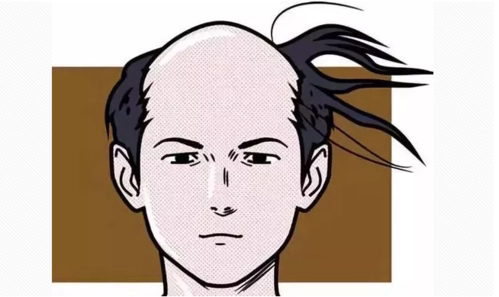 【中山醫(yī)“聲”】守護(hù)發(fā)際線，遠(yuǎn)離“禿”如其來的煩惱！