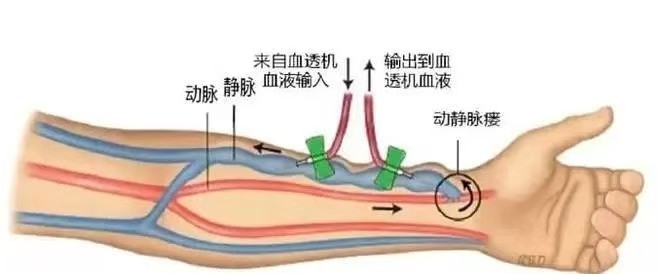【節(jié)氣養(yǎng)生】小滿時(shí)節(jié)，物致小滿，人宜清補(bǔ)!   